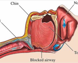 Tongue Health Chart