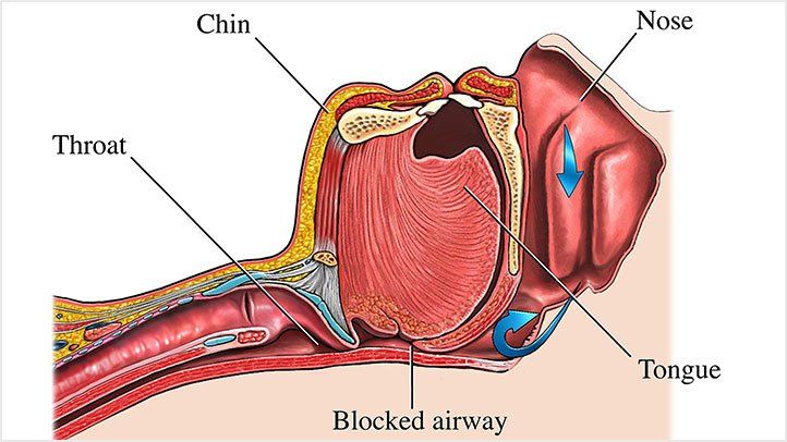 Tongue Health Chart